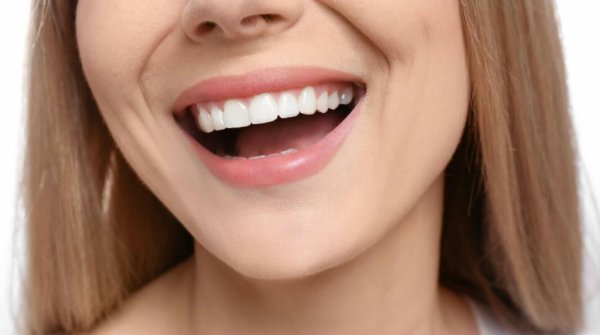 голливудская улыбка виниры