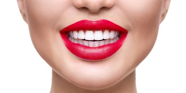 голливудская улыбка