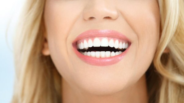 улыбка зубами
