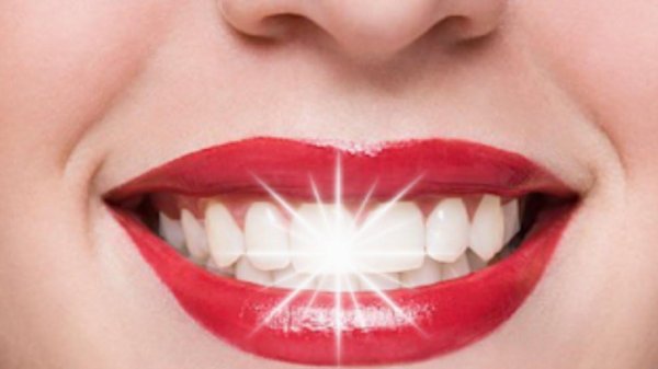 белоснежная улыбка