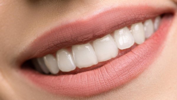идеальные зубы