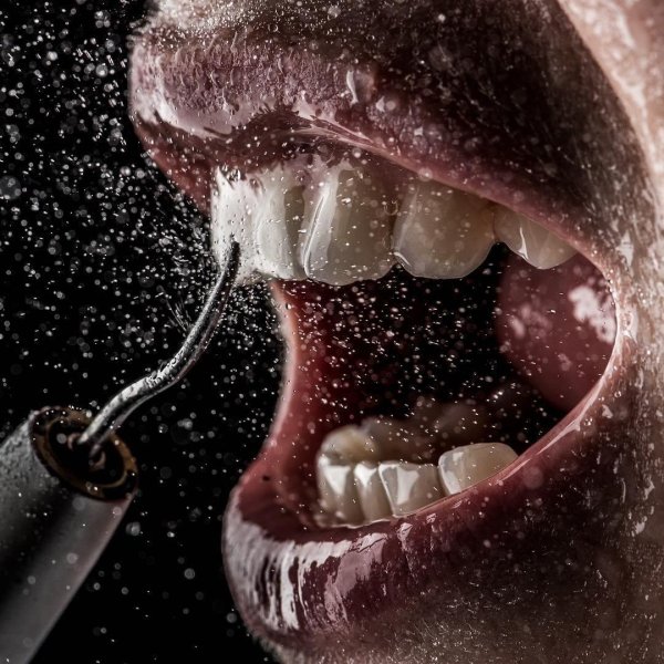 профессиональная гигиена