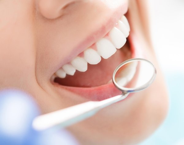 профессиональная чистка зубов