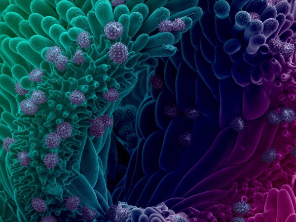 опухолевые клетки микроскоп