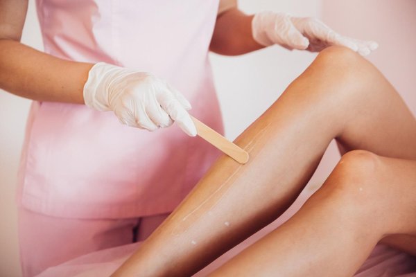 лазерная эпиляция