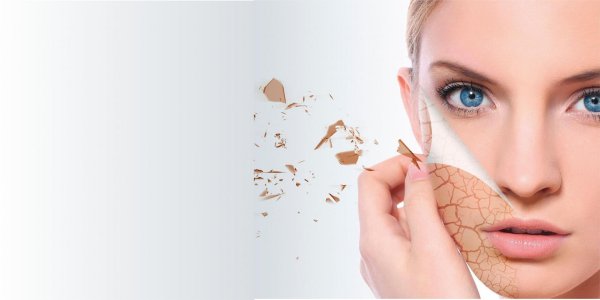 химические пилинги