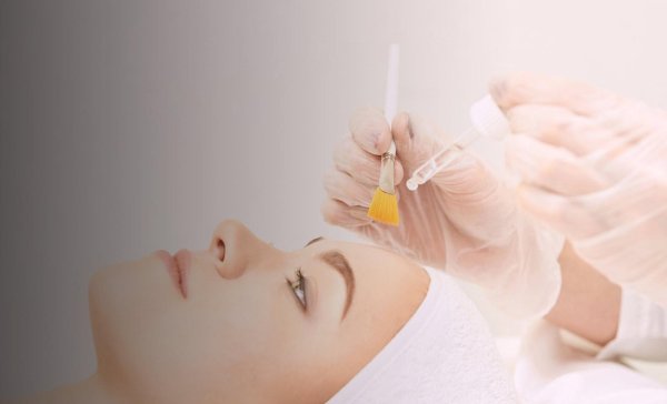 химические пилинги