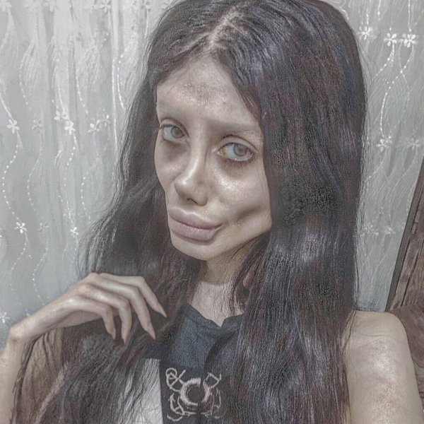 сахар табар до пластики