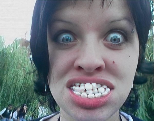 большие зубы