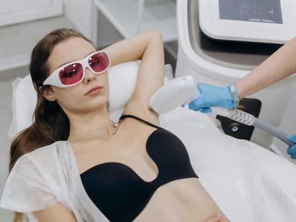 лазерная депиляция