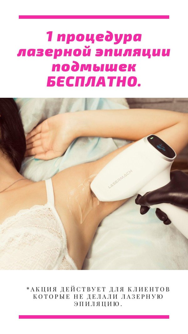 лазерная эпиляция
