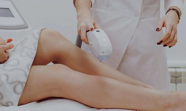 лазерная эпиляция