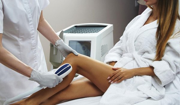 лазерная депиляция