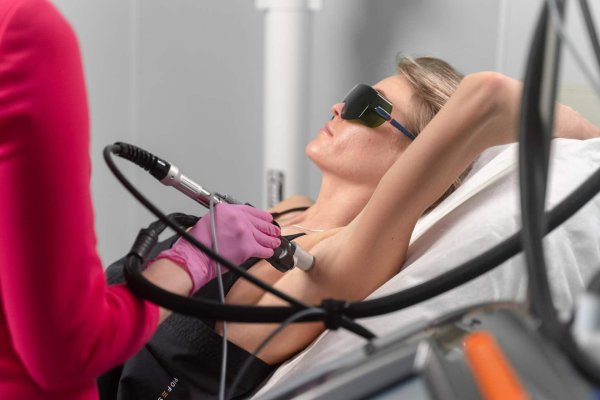 эпиляция александритовым лазером