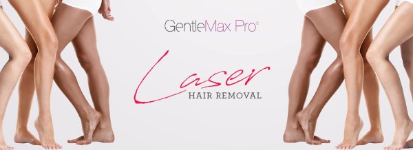 laser hair removal