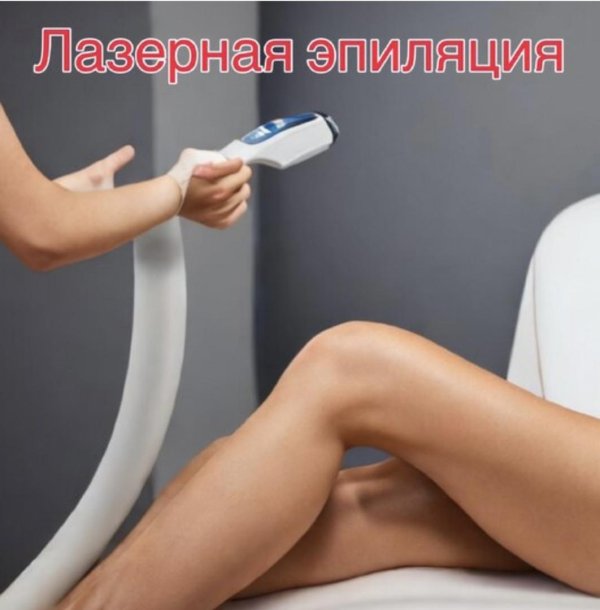 лазерная депиляция