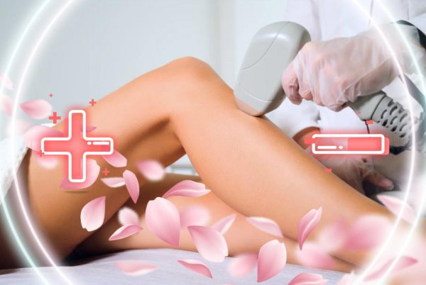 лазерная депиляция