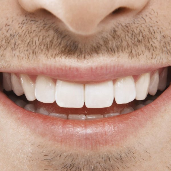 идеальные зубы человека