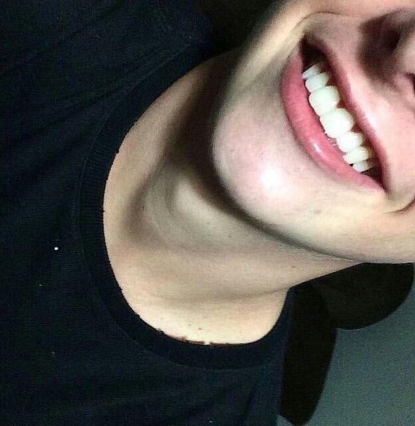 улыбка парня