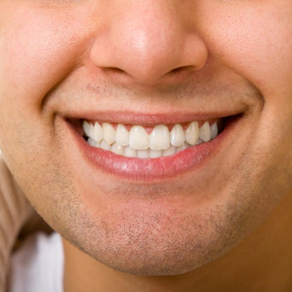 идеальные зубы человека