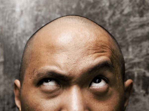 голова лысая