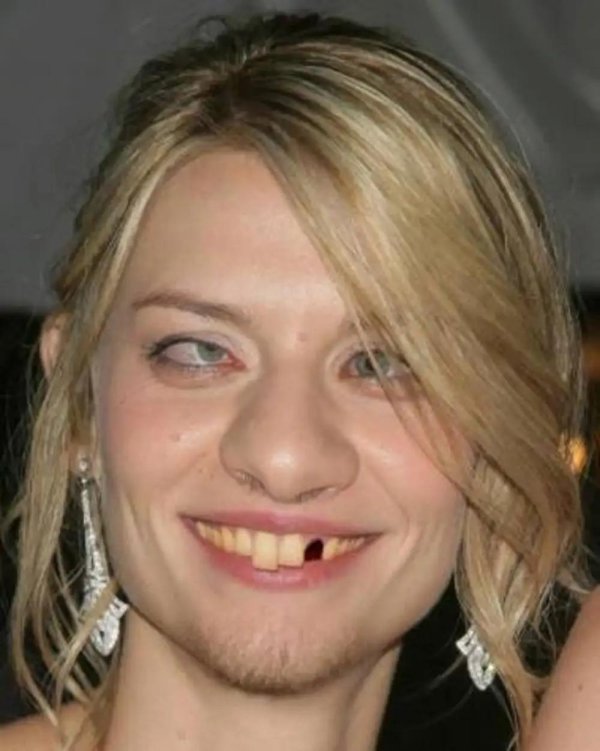 беззубая девушка