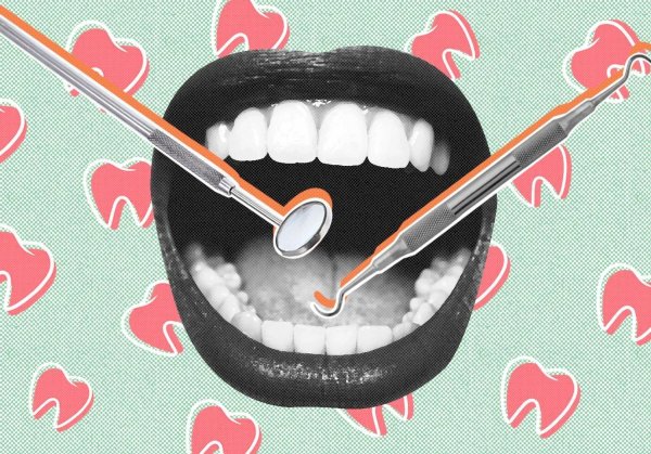 профессиональная гигиена полости рта