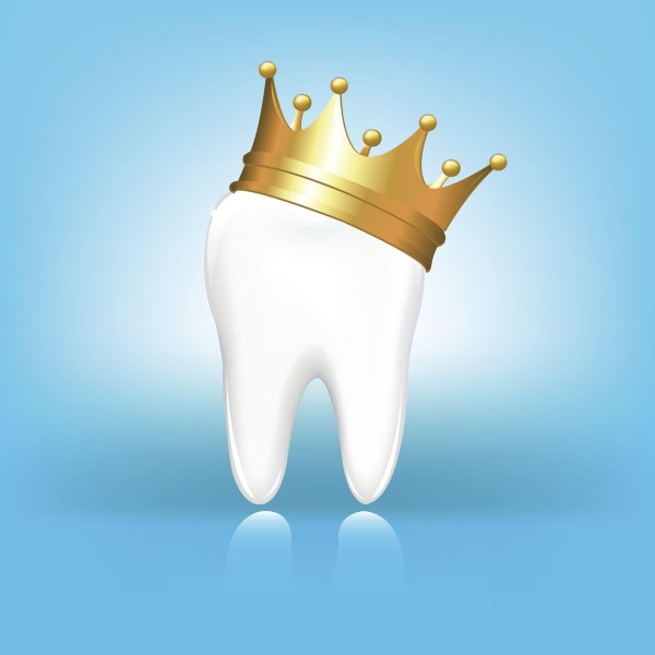dental crown