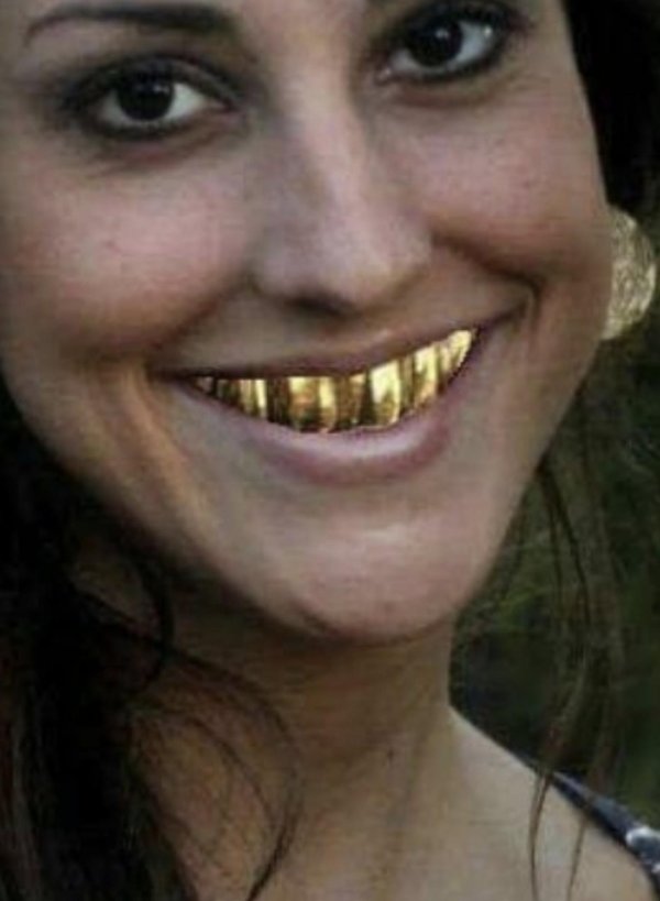 улыбка с золотым зубом