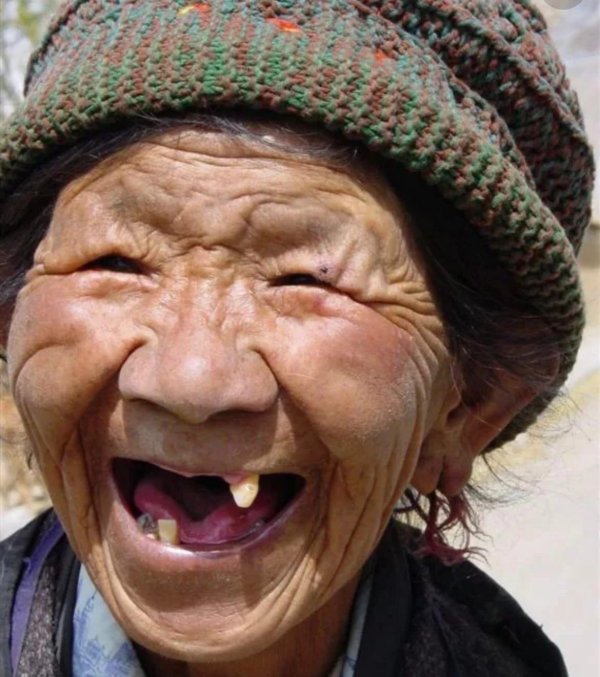 беззубые люди