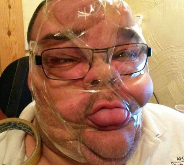 обмотал скотч вокруг головы