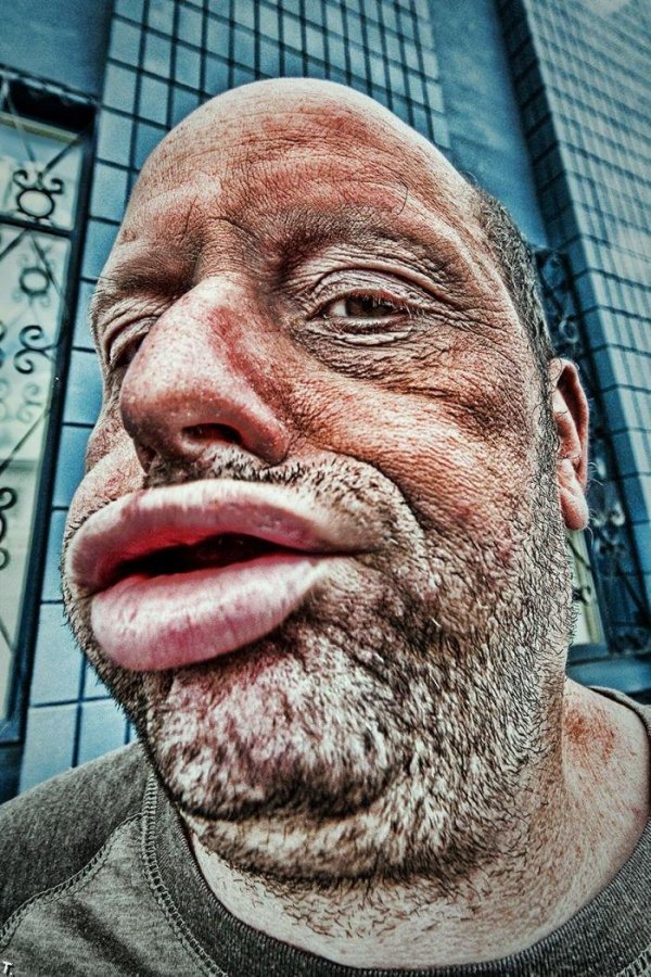 уродливое лицо