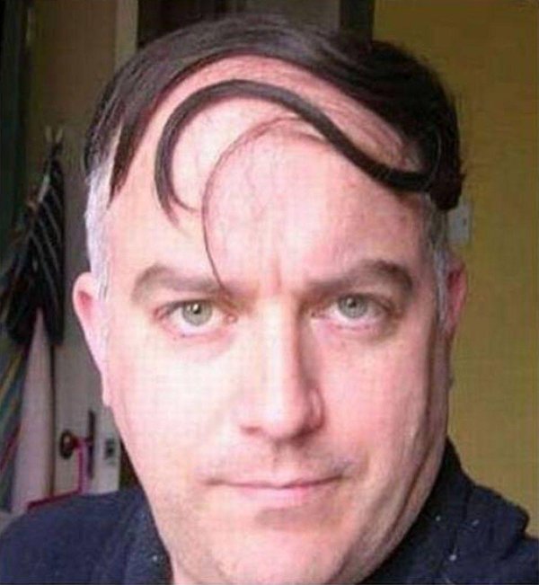 зачес на лысину