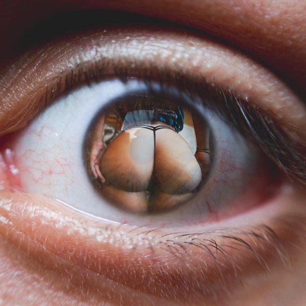 глаз изнутри