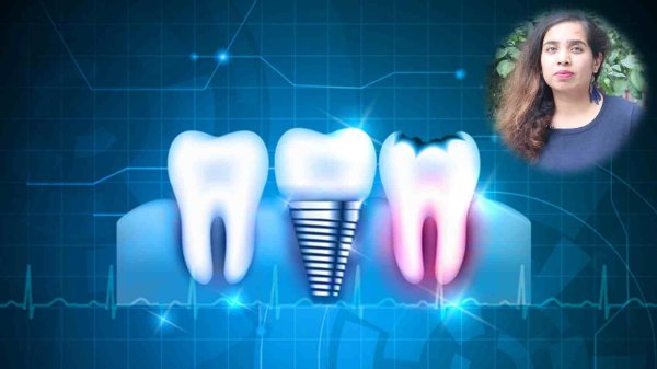 имплантация зубов реклама