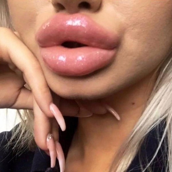 губошлепка кайли