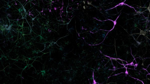 нейроны головного мозга