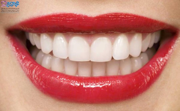 идеальные зубы