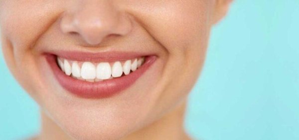 идеальные зубы