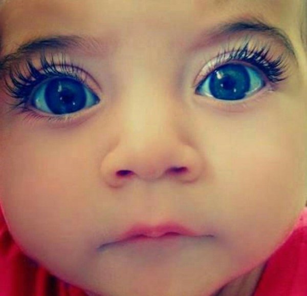 большие глаза у ребенка
